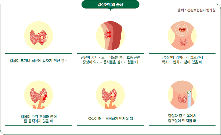 갑상선암의 증상: 결절이 크거나 최근에 갑자기 커진 경우, 결절이 커서 기도나 식도를 눌러 호흡곤란 증상이 있거나 음식물을 삼키기 힘들 때, 갑상선에 덩어리가 있으면서 목소리 변화가 같이 있을 대, 결절이 주위 조직과 붙어 잘 움직이지 않을 때, 결절이 매우 딱딱하게 만져질 때, 결절과 같은 쪽에서 림프절이 만져질 때